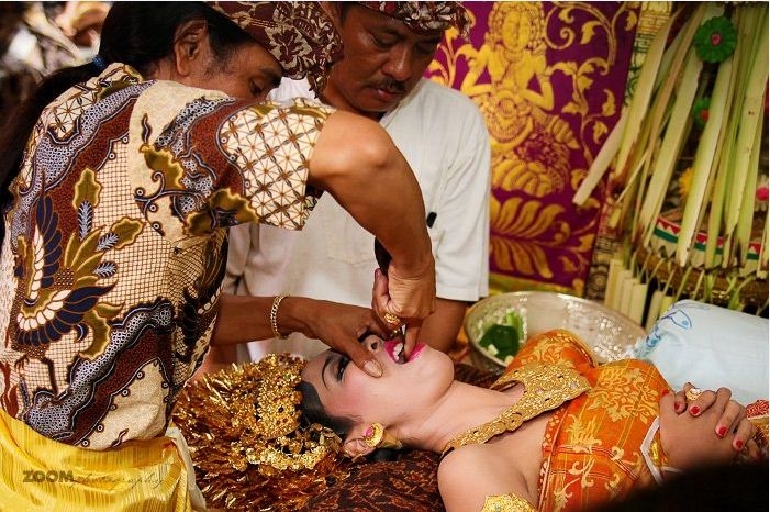 Nghi lễ mài răng của người dân ở Bali